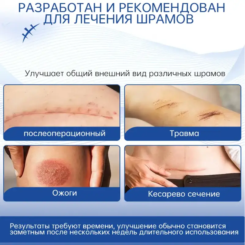 Преимущества MEJISOO Scar Cream