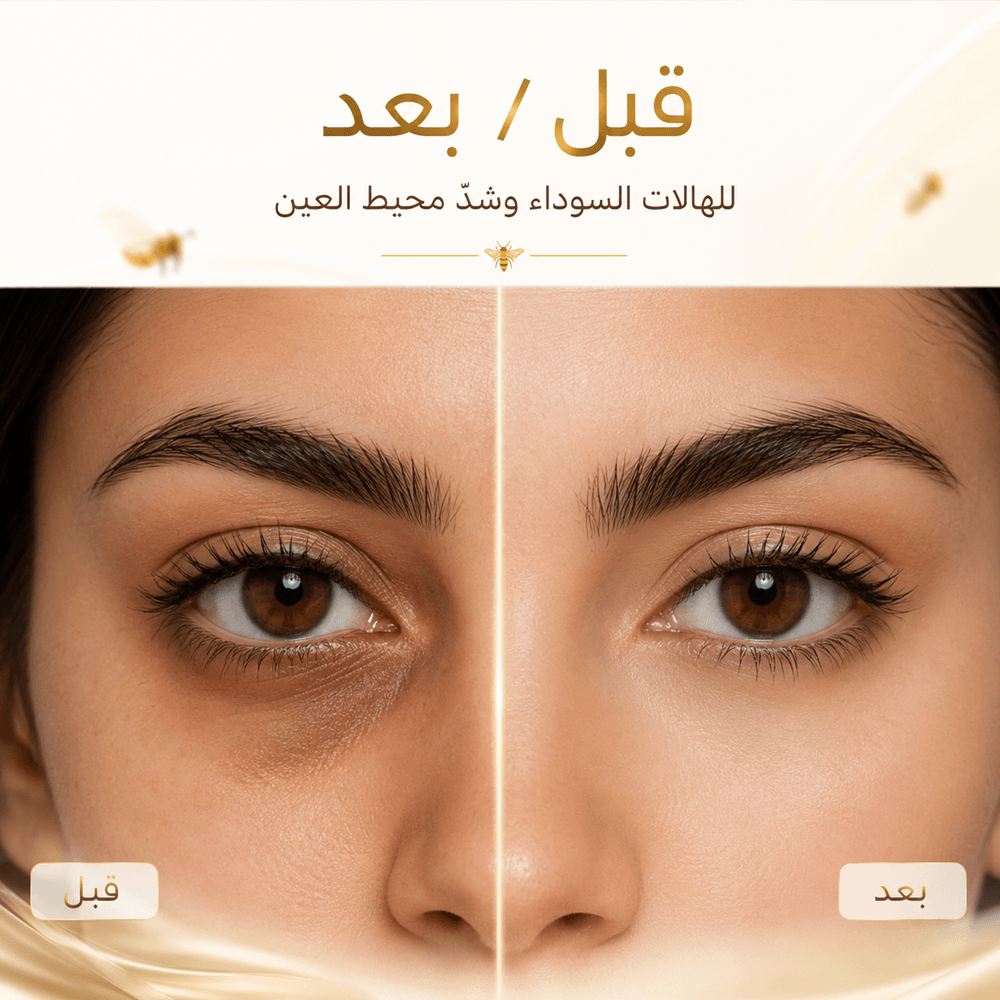 مقارنة قبل وبعد استخدام كريم العين بسم النحل